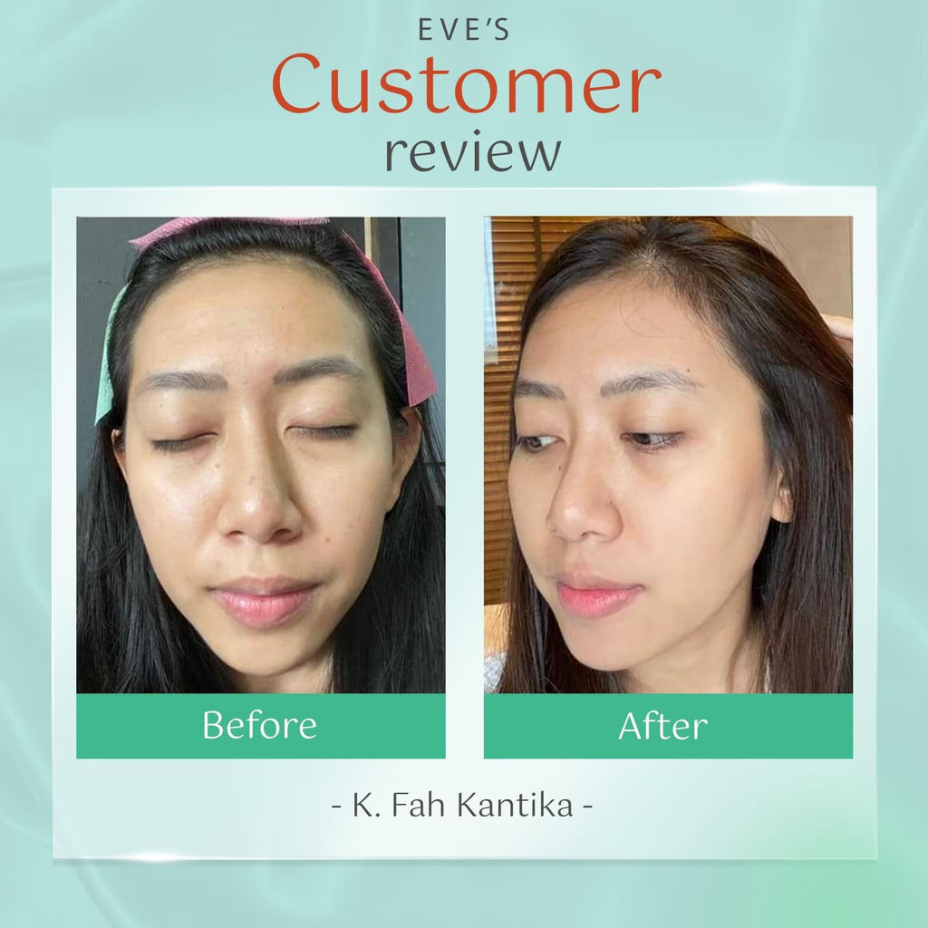 เซทปรับผิวขาวใสเนียนนุ่ม