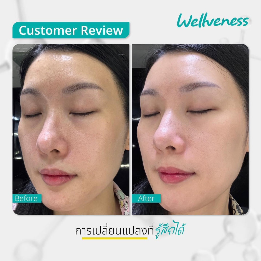 ผิวขาวใสX3