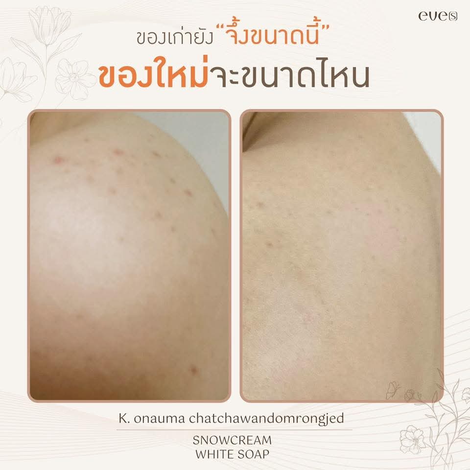 สบู่อีฟส์ ใหม่ *** ราคาพิเศษ