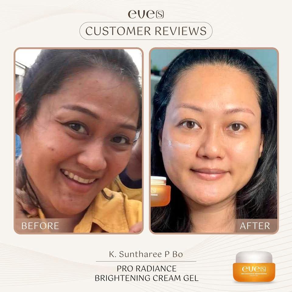 ชุด กันแดด ฟื้นฟู ผิวกระจ่างใส ลดรอยสิว 4 ชิ้น