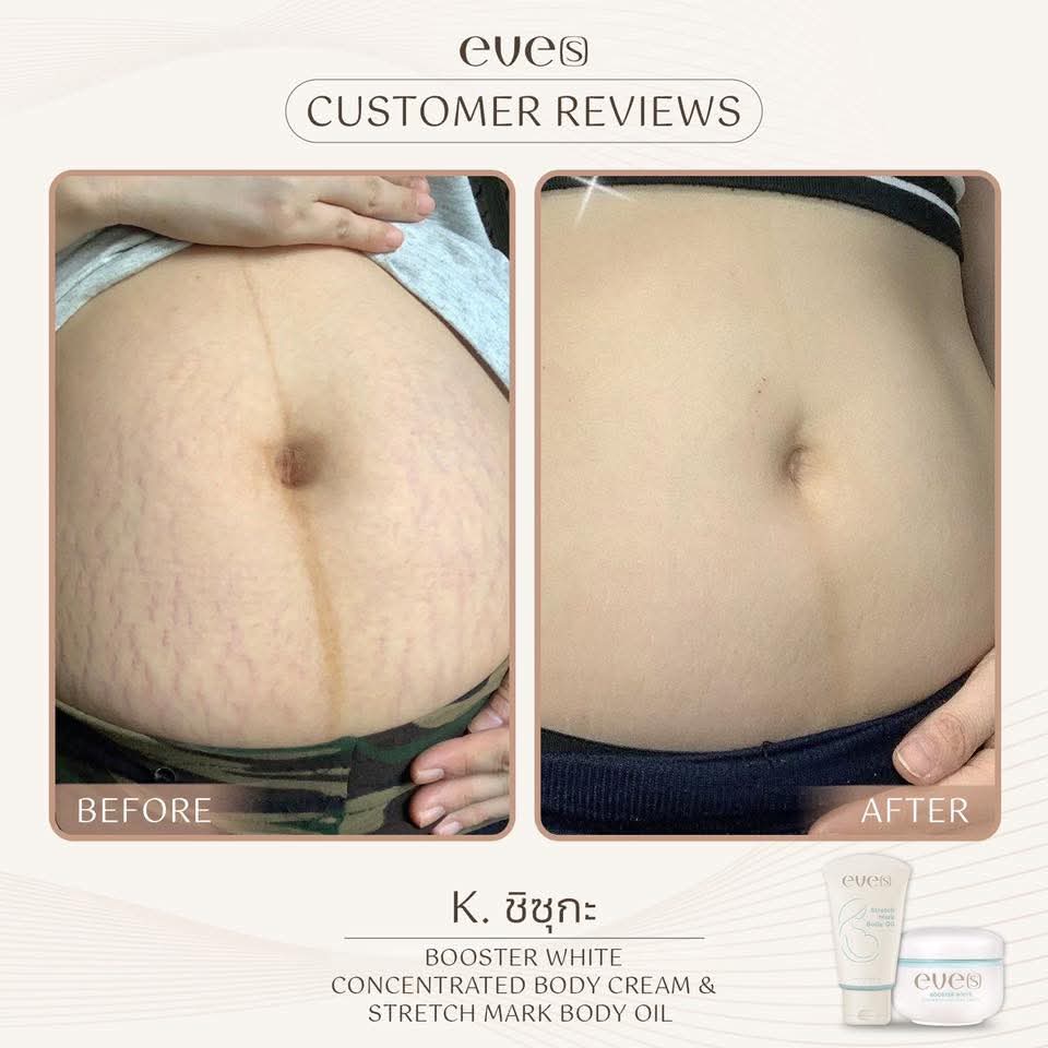 ชุดบำรุงผิวคุณแม่ 1 - 1 อีฟส์ออย / 2 บูสเตอร์ฟ้า