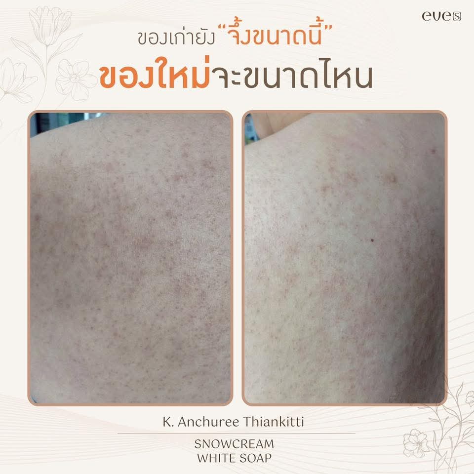 สบู่อีฟส์ ใหม่ *** ราคาพิเศษ