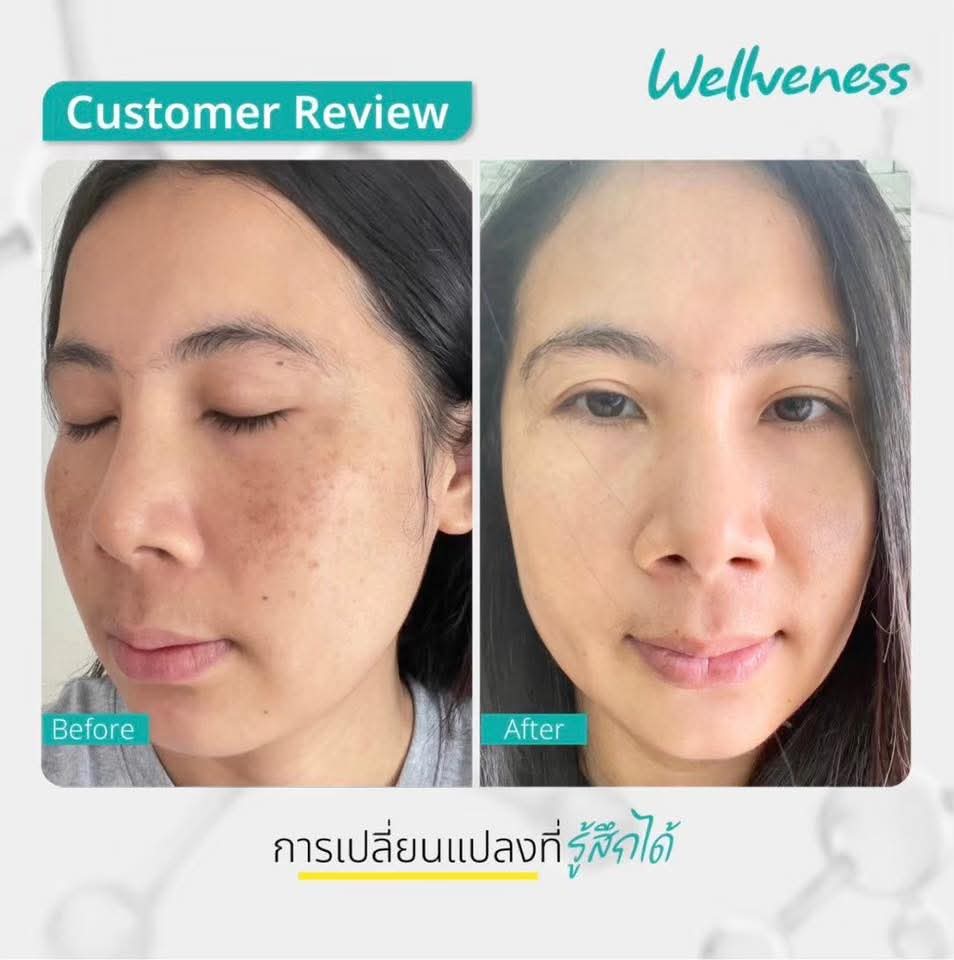 CERABRIGHT- เซราไบรท์ CUCUMIS CERABRIGHT BARRIER SESUM IN CREAM คูคูมิส เซราไบร์ท แบริเอร์ เซรั่ม อิน ครีม